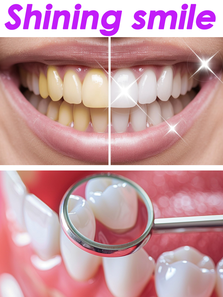 Teeth Whitening Xylitol - GlorySmile Diş Beyazlatma Meyveli Diş Macunu