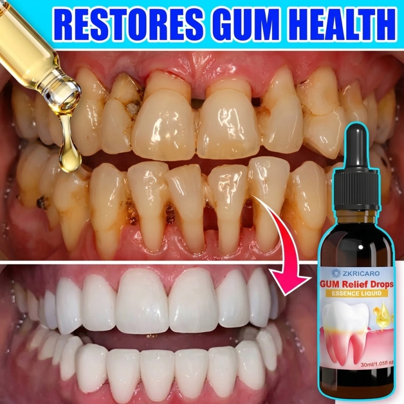 Teeth Whitening Gingival Barrier - Ağız Dişeti Hijyeni, Diş Eti Temizleme