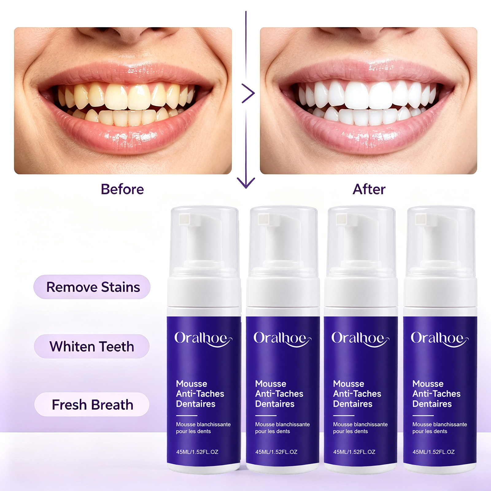Teeth Whitening Routine - Mor Köpüren Diş Beyazlatıcı Diş Macunu
