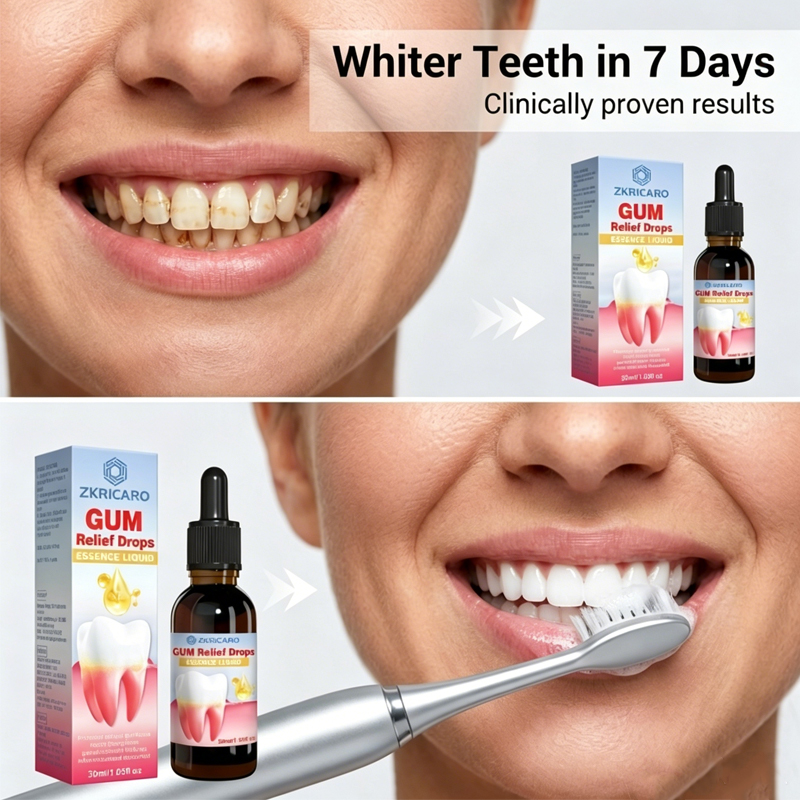 Ağız Dişeti Hijyeni, Diş Eti T - Teeth Whitening Gingival Barrier incelemesi ve fiyatı
