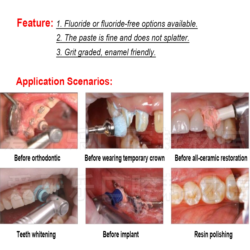 Ivoclar Vivadent Oral Diş Parl - Teeth Whitening Xylitol incelemesi ve fiyatı