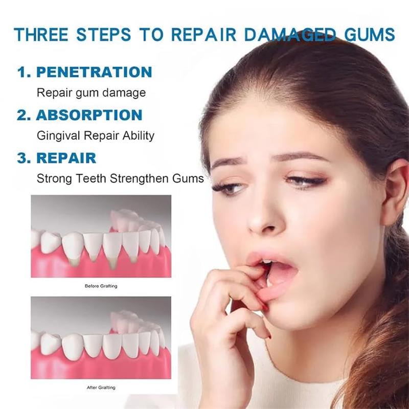 Diş Eti Onarıcı Bakım Serumu,  - Teeth Whitening Gingival Barrier incelemesi ve fiyatı