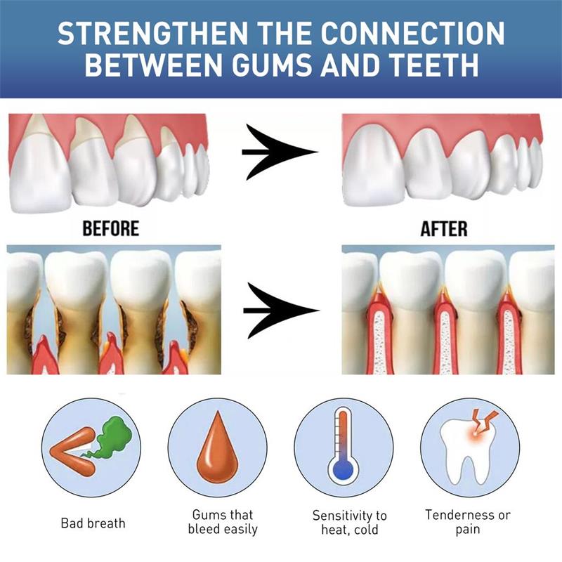 Diş Eti Onarıcı Bakım Serumu,  - Teeth Whitening Gingival Barrier incelemesi ve fiyatı