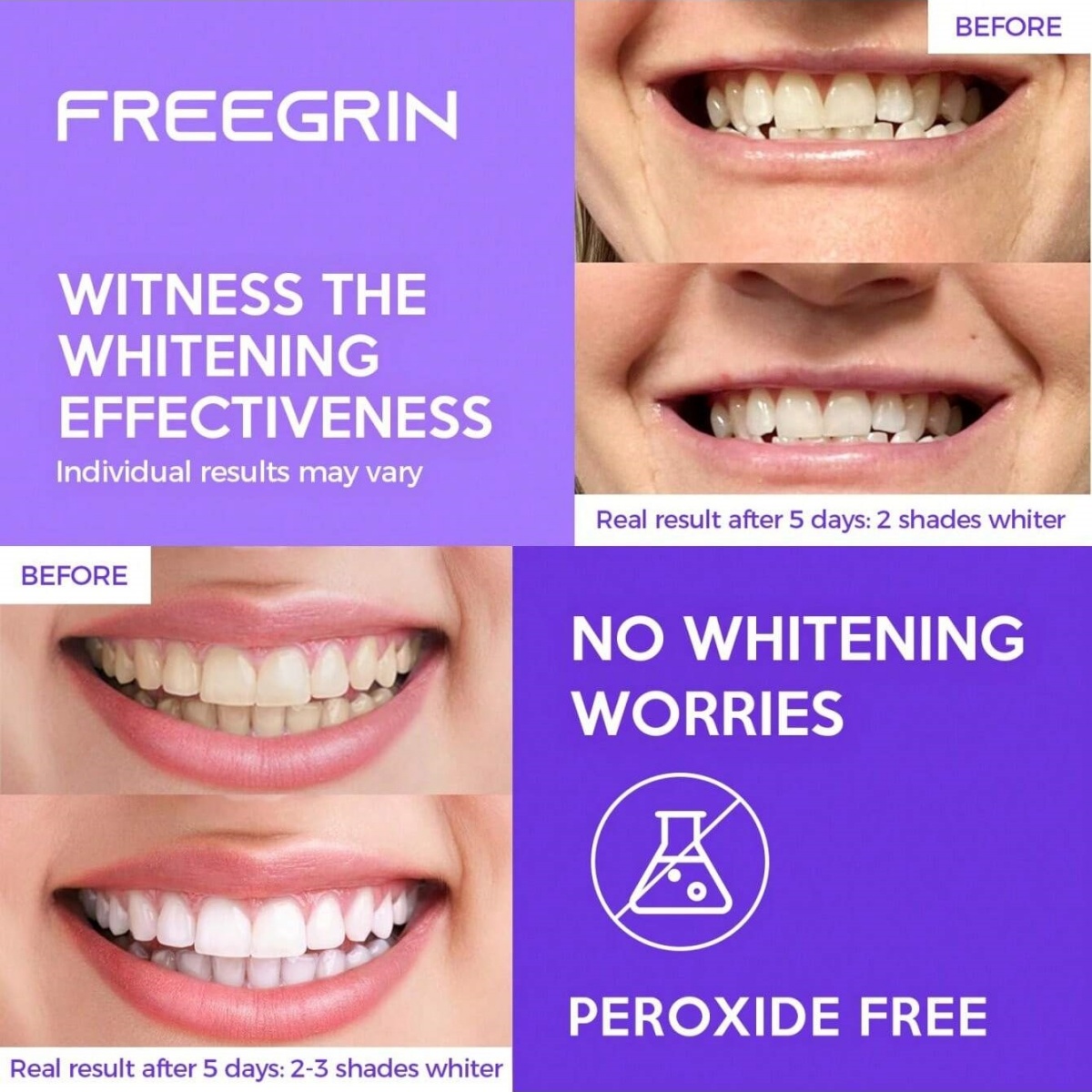 Deluxe Beyazlatma Diş Çıkartma - Teeth Whitening Quotes incelemesi ve fiyatı