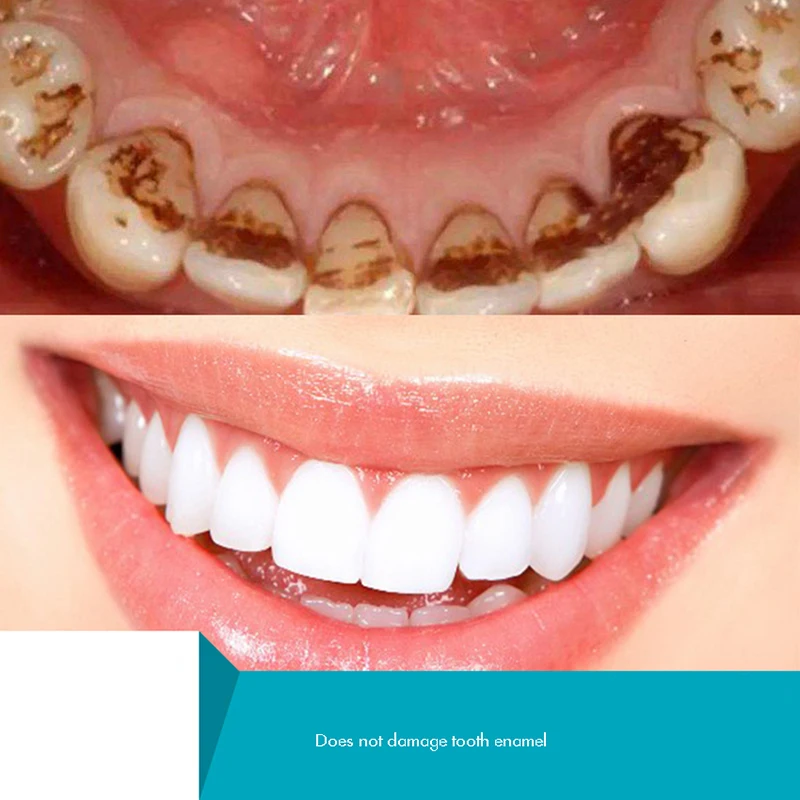 Bitkisel diş tozu, doğal diş b - Teeth Whitening Xylitol incelemesi ve fiyatı