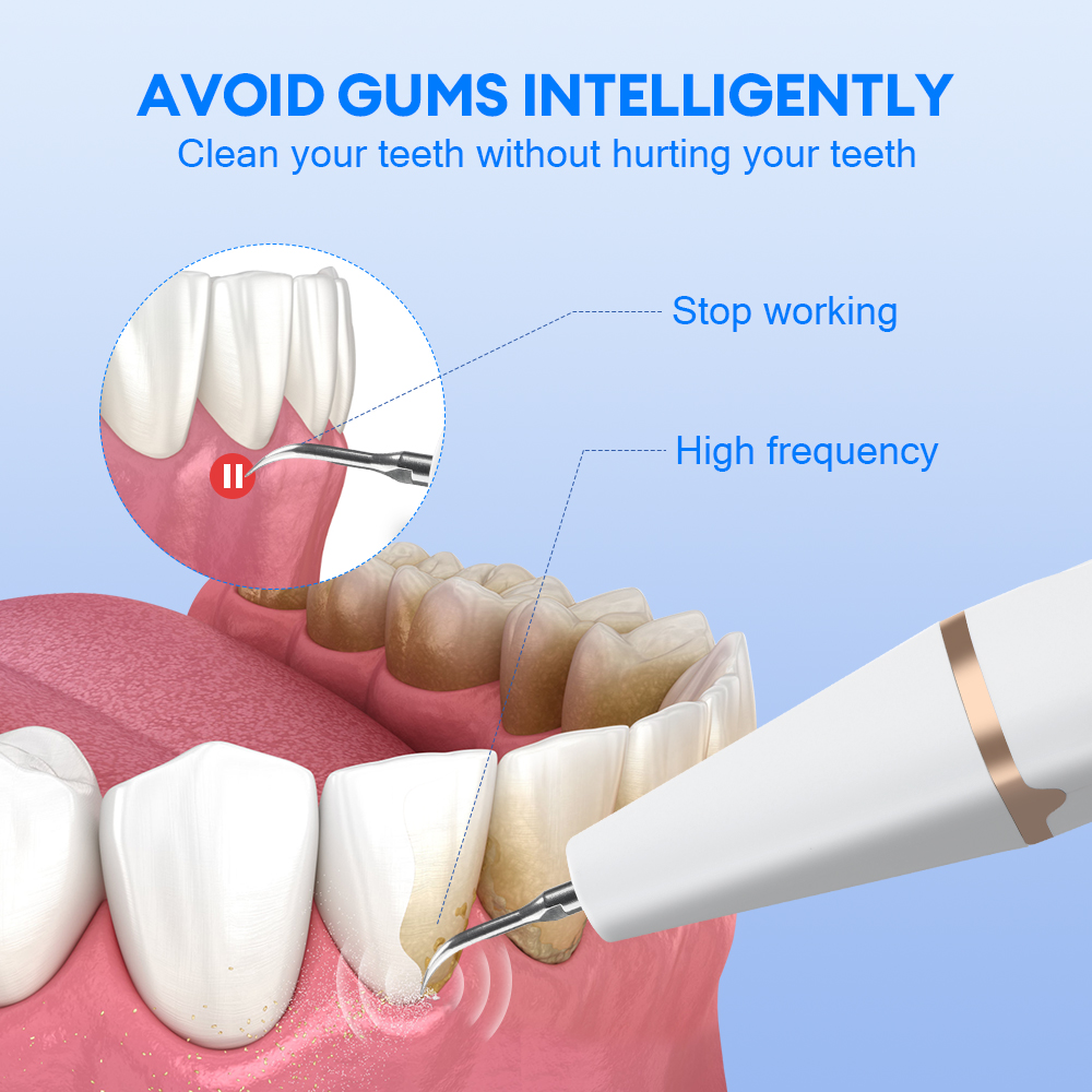Ultrasonik Diş Taşı Temizleyic - Teeth Whitening Tips incelemesi ve fiyatı